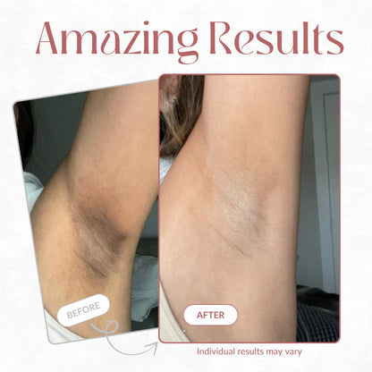 Zenaviva™ Aceite de Masaje Anticelulitis