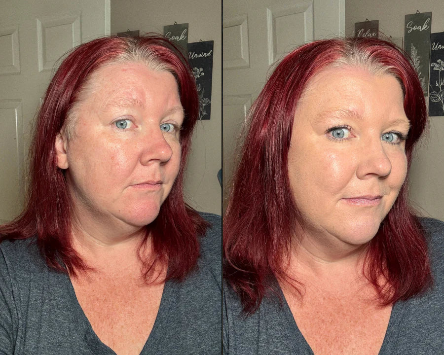 Zenaviva™ Aceite de Masaje Anticelulitis